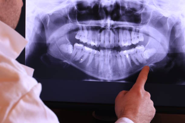 Best Broken or Cracked Tooth Emergency Dentist in Finderne, NJ